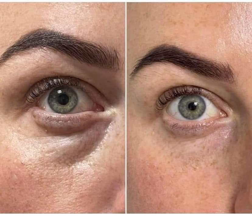 Fontainavie Complex Eye Serum - 4